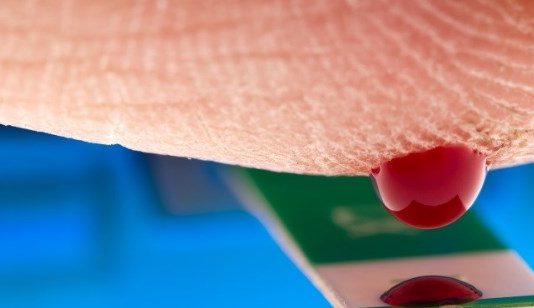 Glucose Levels in the Blood: Norm and Pathology