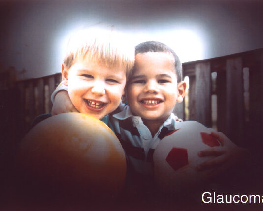 7 Glaucoma Myths That You Must Steer Clear From