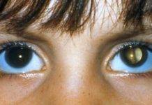 10 Signs that your Child has Vision Problems