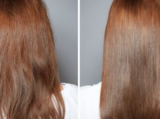 Tips to recover damaged hair when you have already tried EVERYTHING