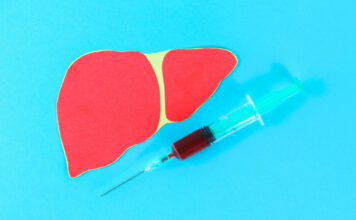 Liver Cancer – An Overview of Different Stages liver cancer