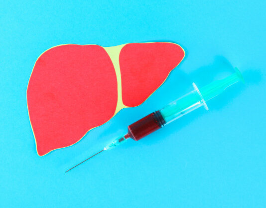 Liver Cancer – An Overview of Different Stages liver cancer