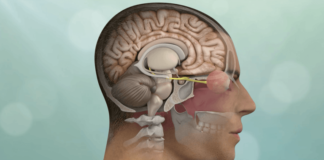 A comprehensive analysis and snapshot of the psychiatric behavioural disorders monitoring market psychiatric behavioral disorders monitoring market