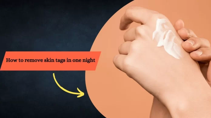 how to remove skin tags in one night